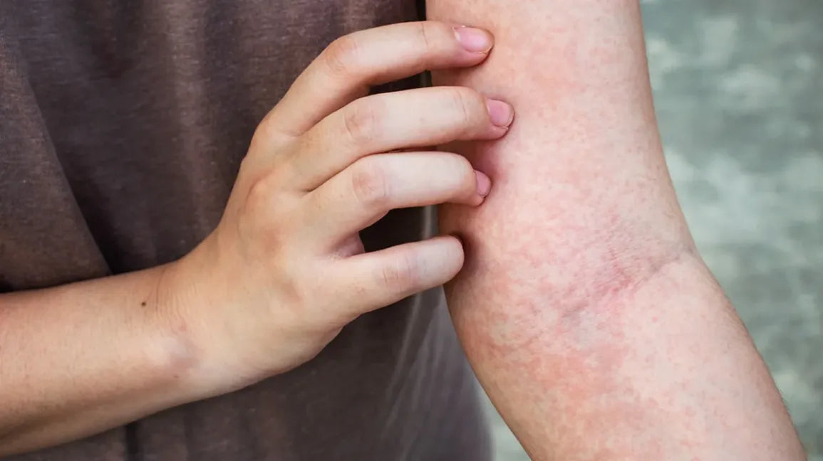 All Time Best For Itching Treatment